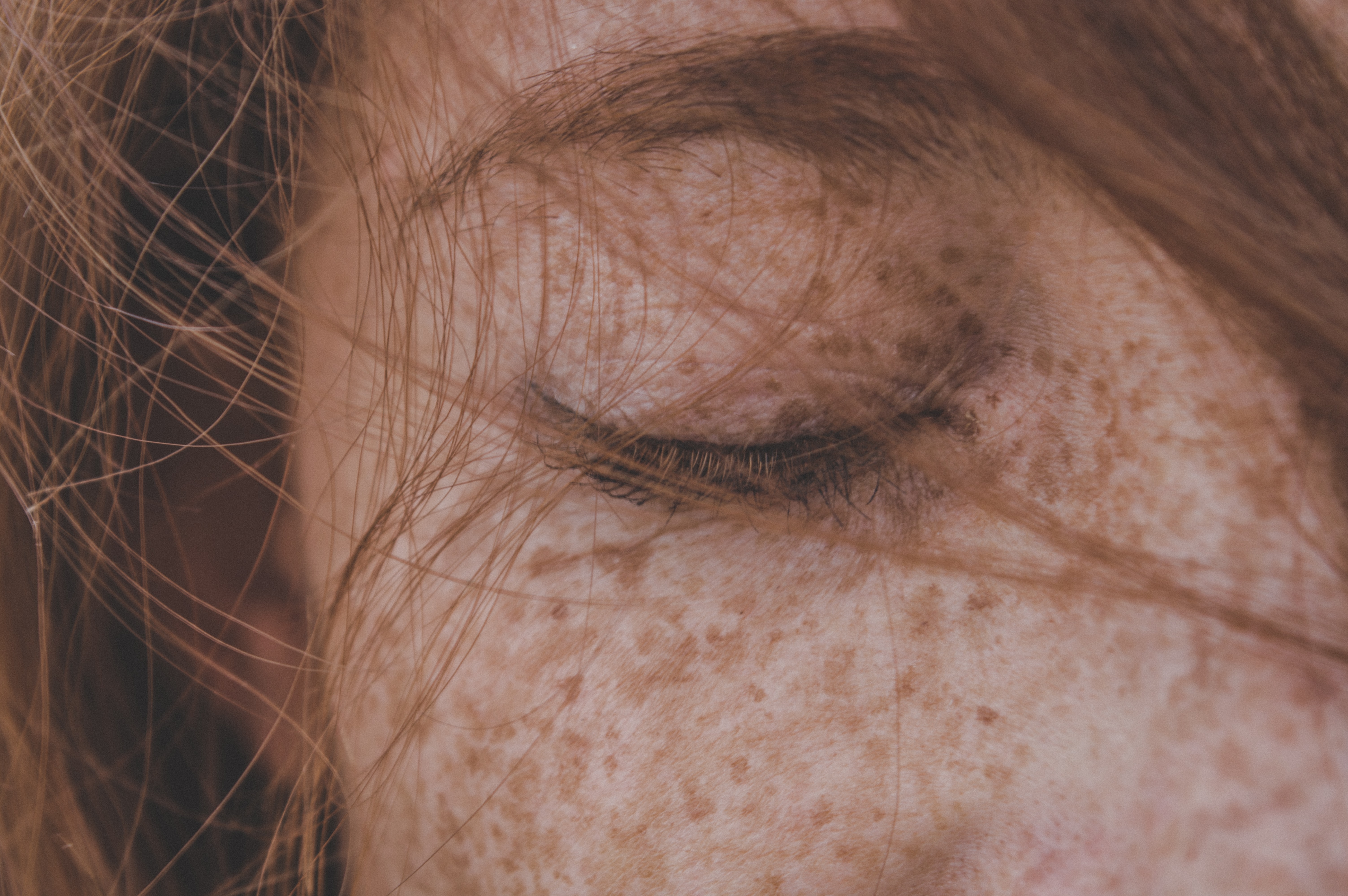 बदसूरत बनाने वाला रोग-लड़कियों के चेहरे पर बाल क्यों आ जाते हैं?